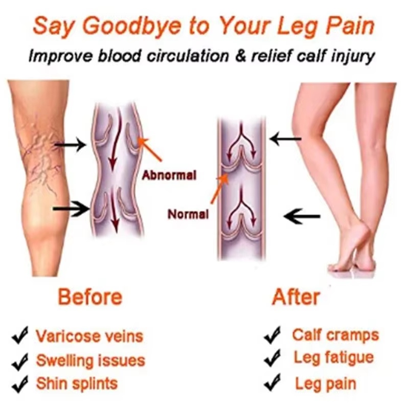 Kadınlar İçin Kompresyon Çorap - Compression Sleeve Calf incelemesi ve fiyatı